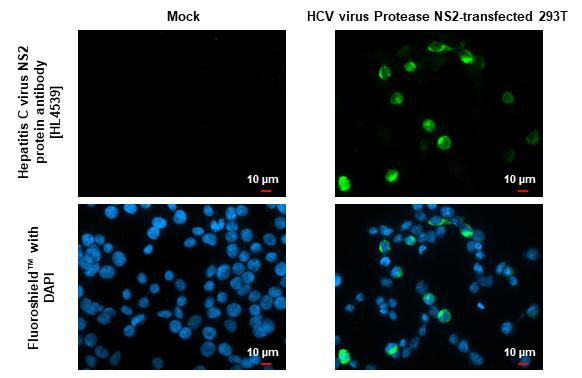 Hepatitis C Virus NS2 Antibody in Immunocytochemistry (ICC/IF)