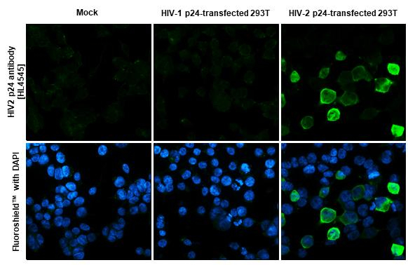 HIV2 p24 Antibody in Immunocytochemistry (ICC/IF)