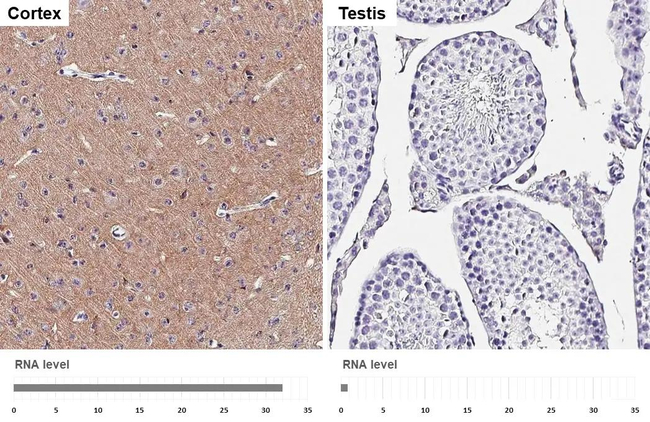 GABBR2 Antibody in Immunohistochemistry (Paraffin) (IHC (P))