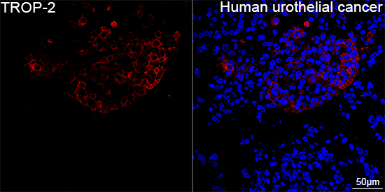 TROP2 Antibody in Immunohistochemistry (Paraffin) (IHC (P))