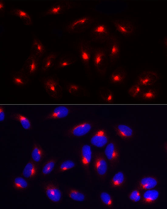 RAB11A/RAB11B Antibody in Immunocytochemistry (ICC/IF)