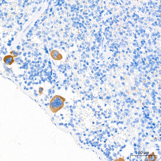 VWF Antibody in Immunohistochemistry (Paraffin) (IHC (P))
