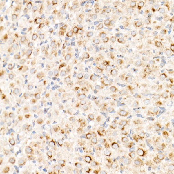 IGF2R Antibody in Immunohistochemistry (Paraffin) (IHC (P))