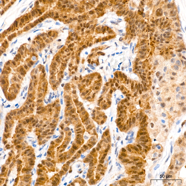 HSP70 Antibody in Immunohistochemistry (Paraffin) (IHC (P))