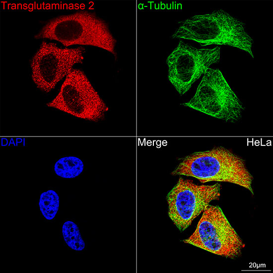TGM2 Antibody in Immunocytochemistry (ICC/IF)
