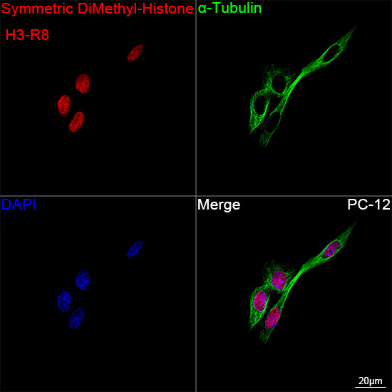 H3R8me2s Antibody in Immunocytochemistry (ICC/IF)