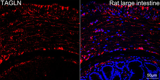 TAGLN Antibody in Immunohistochemistry (Paraffin) (IHC (P))