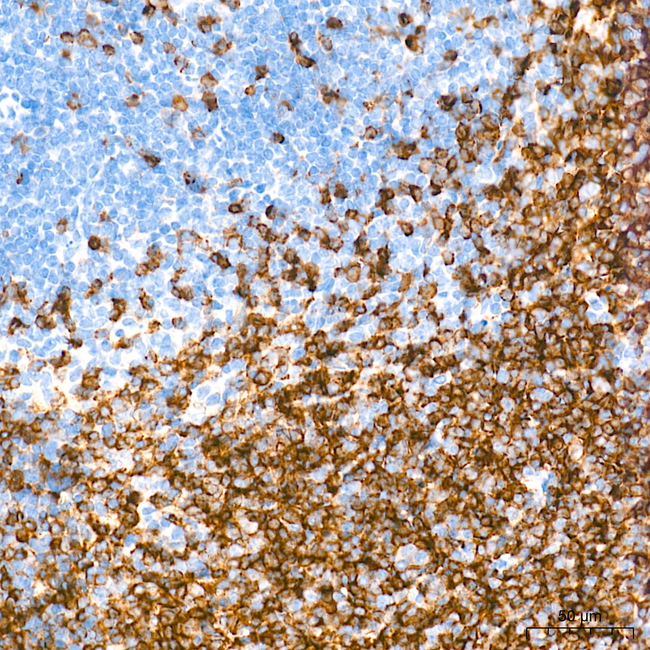 CD79b Antibody in Immunohistochemistry (Paraffin) (IHC (P))