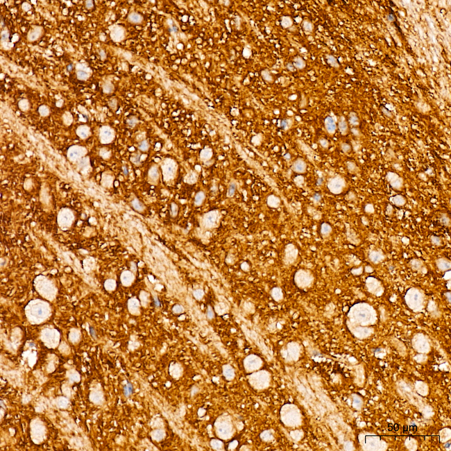 TrkB Antibody in Immunohistochemistry (Paraffin) (IHC (P))