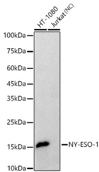 NY-ESO-1 Antibody in Western Blot (WB)