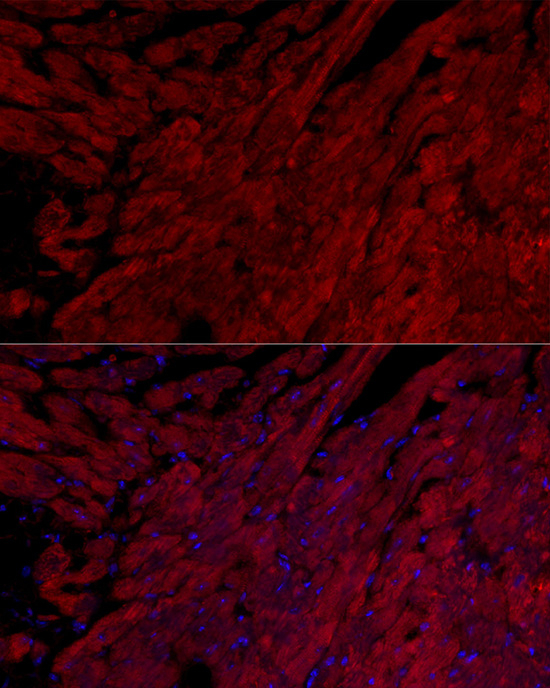 Cardiac Troponin I Antibody in Immunohistochemistry (Paraffin) (IHC (P))