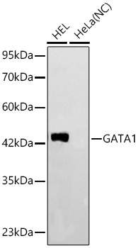 GATA1 Antibody in Western Blot (WB)