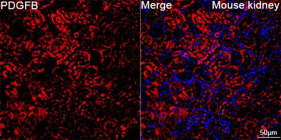 PDGF-B Antibody in Immunohistochemistry (Paraffin) (IHC (P))