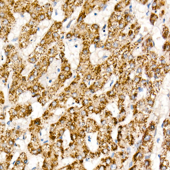 HAO1 Antibody in Immunohistochemistry (Paraffin) (IHC (P))