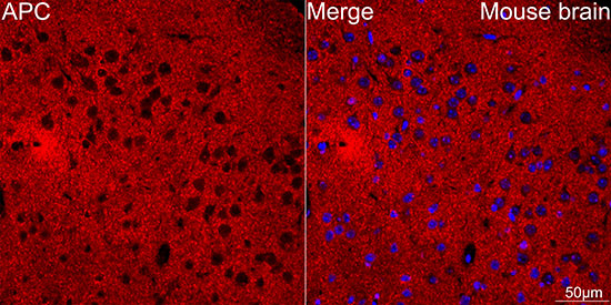 Protein APC Antibody in Immunohistochemistry (Paraffin) (IHC (P))