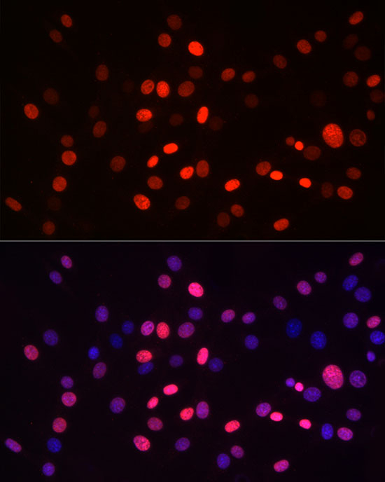 H3K9me1 Antibody in Immunocytochemistry (ICC/IF)