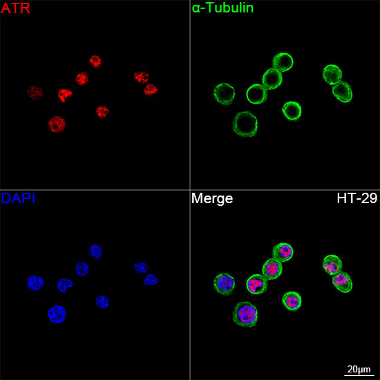 ATR Antibody in Immunocytochemistry (ICC/IF)