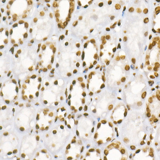 H3R8me2a Antibody in Immunohistochemistry (Paraffin) (IHC (P))