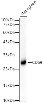 CD69 Antibody in Western Blot (WB)