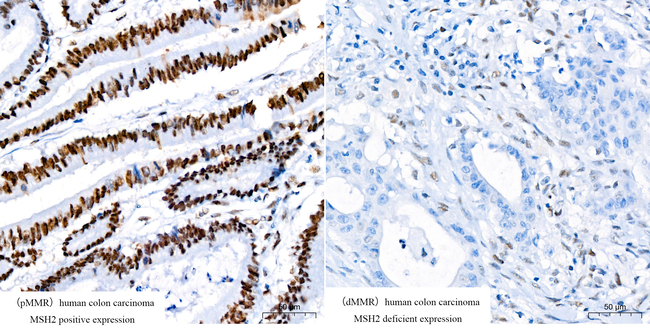MSH2 Antibody in Immunohistochemistry (Paraffin) (IHC (P))