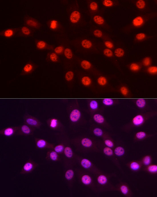 H3K4me3 Antibody in Immunocytochemistry (ICC/IF)