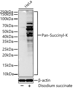 Pan Succinyl Lysine Antibody in Western Blot (WB)