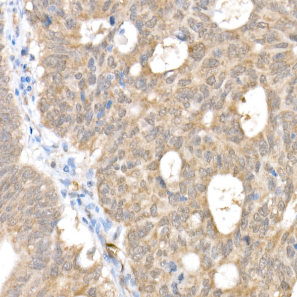 SMAD1 Antibody in Immunohistochemistry (Paraffin) (IHC (P))