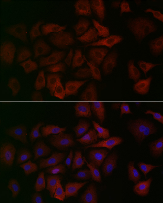 ALDH1A1 Antibody in Immunocytochemistry (ICC/IF)