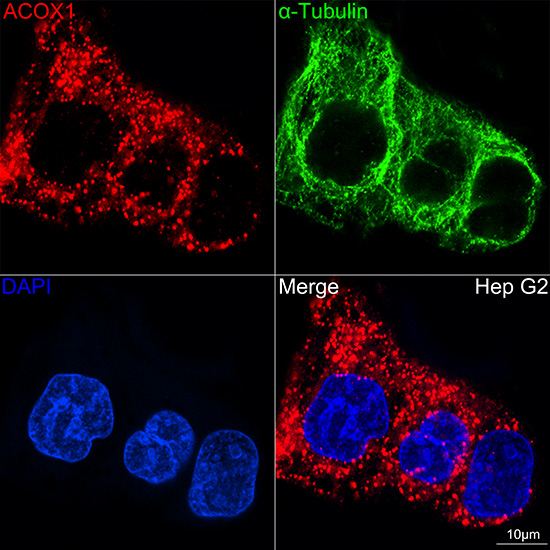 ACOX1 Antibody in Immunocytochemistry (ICC/IF)