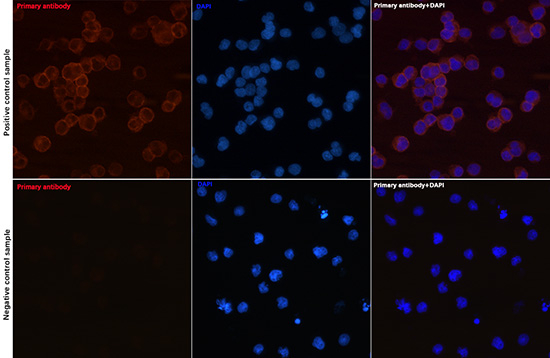 CD79a Antibody in Immunocytochemistry (ICC/IF)