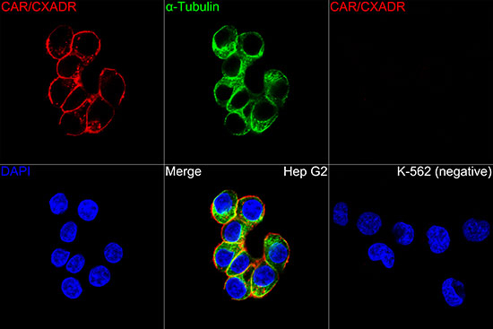 CAR Antibody in Immunocytochemistry (ICC/IF)