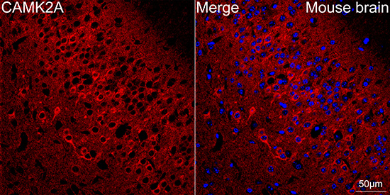 CaMKII alpha Antibody in Immunohistochemistry (Paraffin) (IHC (P))