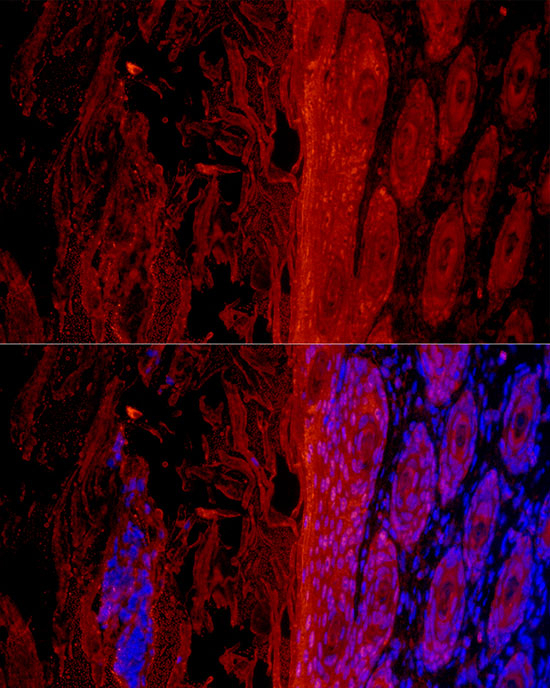 GSDMA Antibody in Immunohistochemistry (Paraffin) (IHC (P))