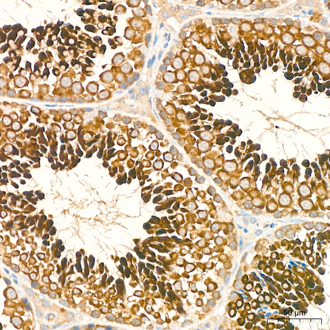 LKB1 Antibody in Immunohistochemistry (Paraffin) (IHC (P))