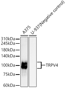 TRPV4 Antibody in Western Blot (WB)