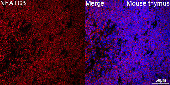 NFATC3 Antibody in Immunohistochemistry (Paraffin) (IHC (P))
