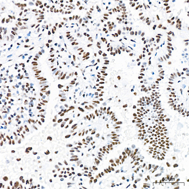 ATF2 Antibody in Immunohistochemistry (Paraffin) (IHC (P))