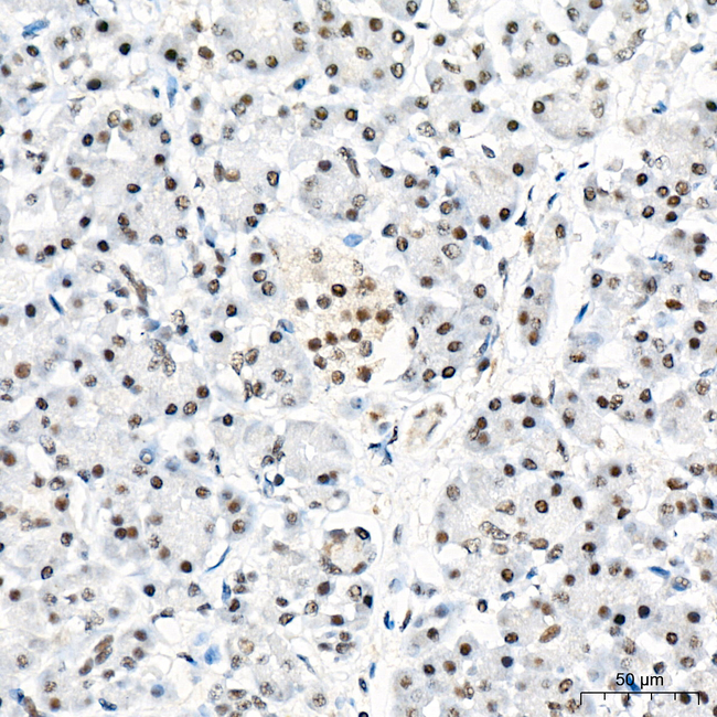 PCAF Antibody in Immunohistochemistry (Paraffin) (IHC (P))
