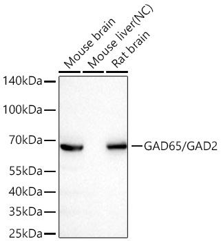 GAD65 Antibody in Western Blot (WB)