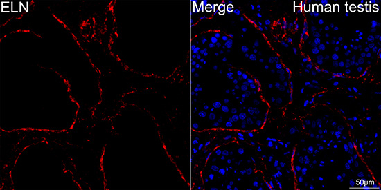Elastin Antibody in Immunocytochemistry (ICC/IF)