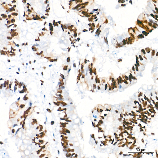 WTAP Antibody in Immunohistochemistry (Paraffin) (IHC (P))