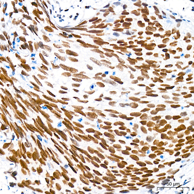 H4K12ac Antibody in Immunohistochemistry (Paraffin) (IHC (P))
