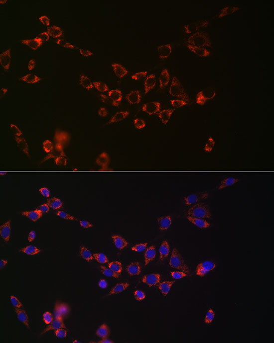 NGLY1 Antibody in Immunocytochemistry (ICC/IF)