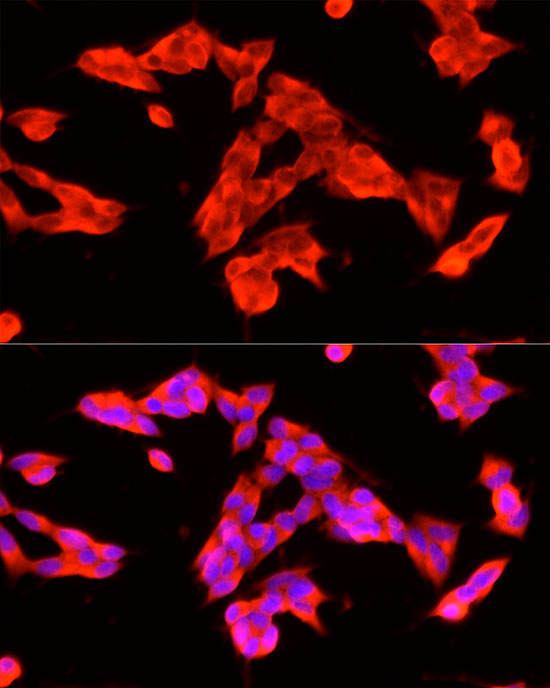 HTR3A Antibody in Immunocytochemistry (ICC/IF)