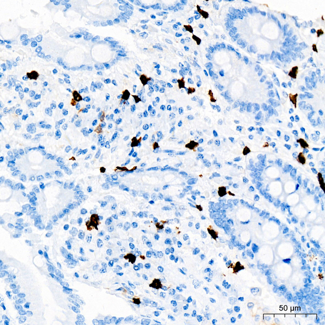 ALOX15 Antibody in Immunohistochemistry (Paraffin) (IHC (P))