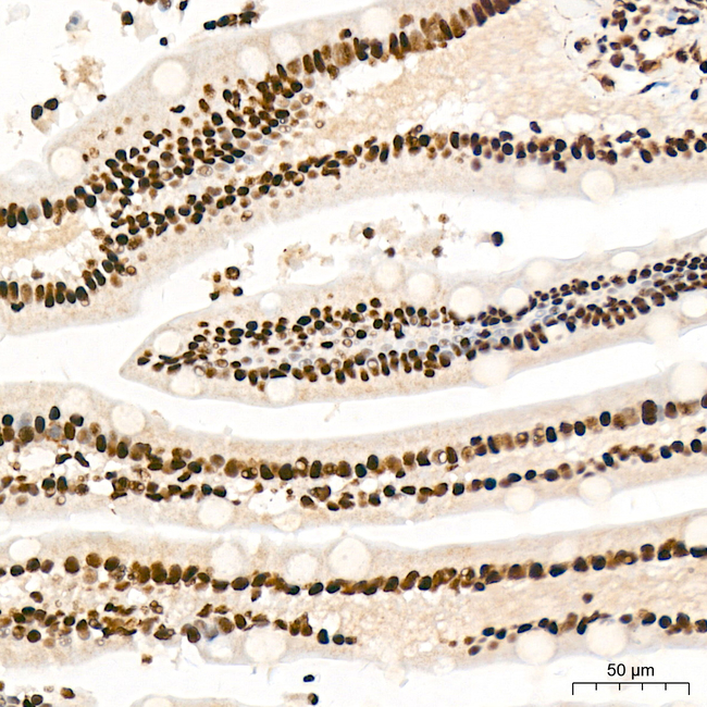YTHDC1 Antibody in Immunohistochemistry (Paraffin) (IHC (P))
