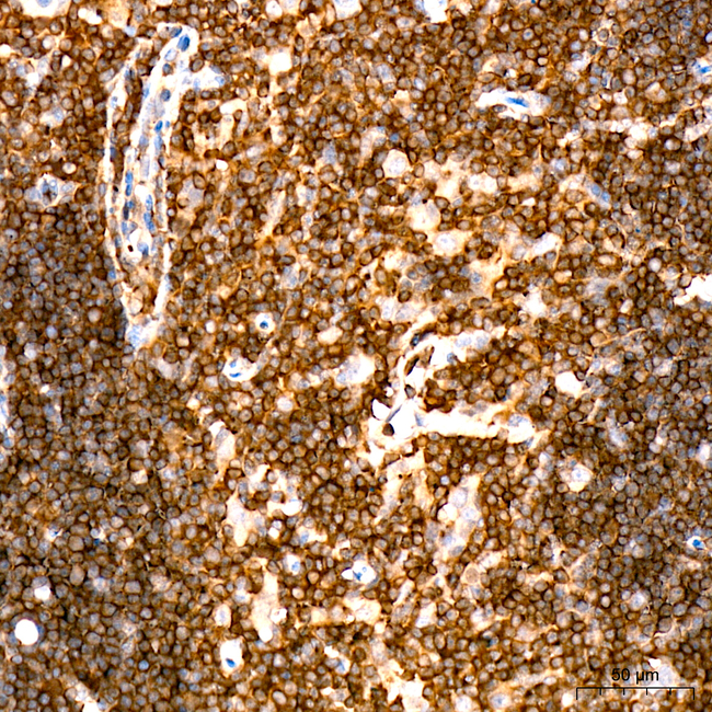 c-Cbl Antibody in Immunohistochemistry (Paraffin) (IHC (P))