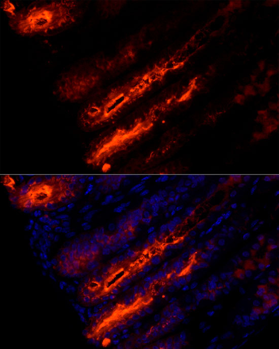 TFF1 Antibody in Immunohistochemistry (Paraffin) (IHC (P))