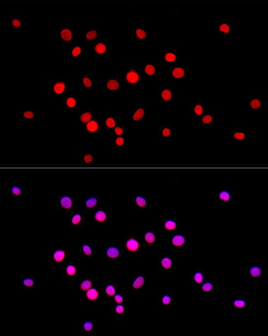 Histone H4 Antibody in Immunocytochemistry (ICC/IF)
