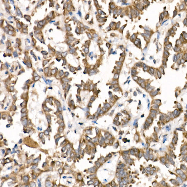 PTP1B Antibody in Immunohistochemistry (Paraffin) (IHC (P))